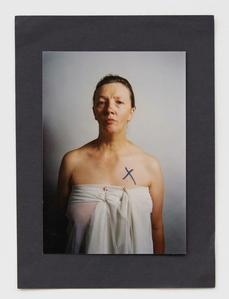 Jo SPENCE, A Picture of Health: How Do I Begin?, 1984