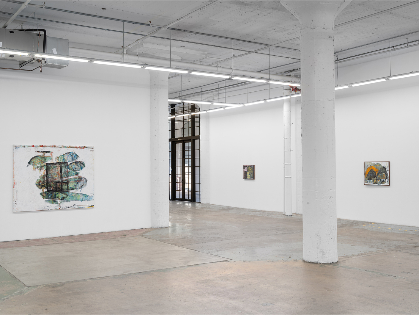 June Canedo de Souza: All top teeth knocked out at once