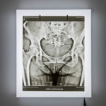 Jiang Li 蒋立, Bear 熊, 2012