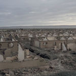 Liu Xin, teratoma, 2019