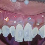 Thumbnail of additional image