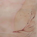 Xin Liu, Teratoma , 2019