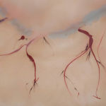 Xin Liu, Teratoma , 2019