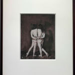 Katie Eleanor, VIII. Omphalopagus monster, an orphan, 2015