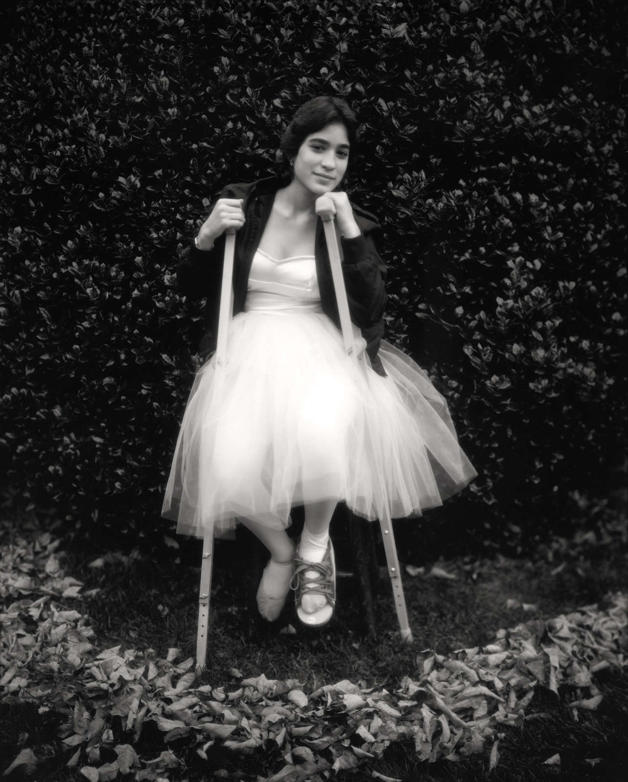 Sally Mann, Debbie's Broken Foot (At Twelve), 1983-1985