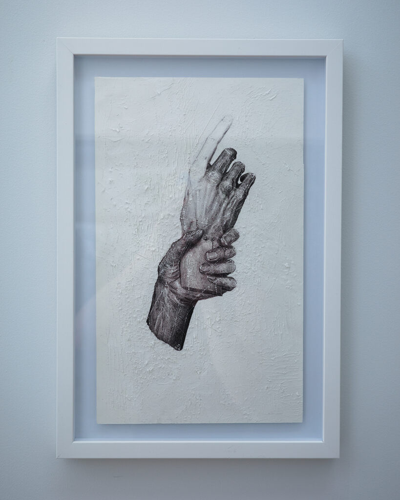 Armando Franco, Amputacion, 2022