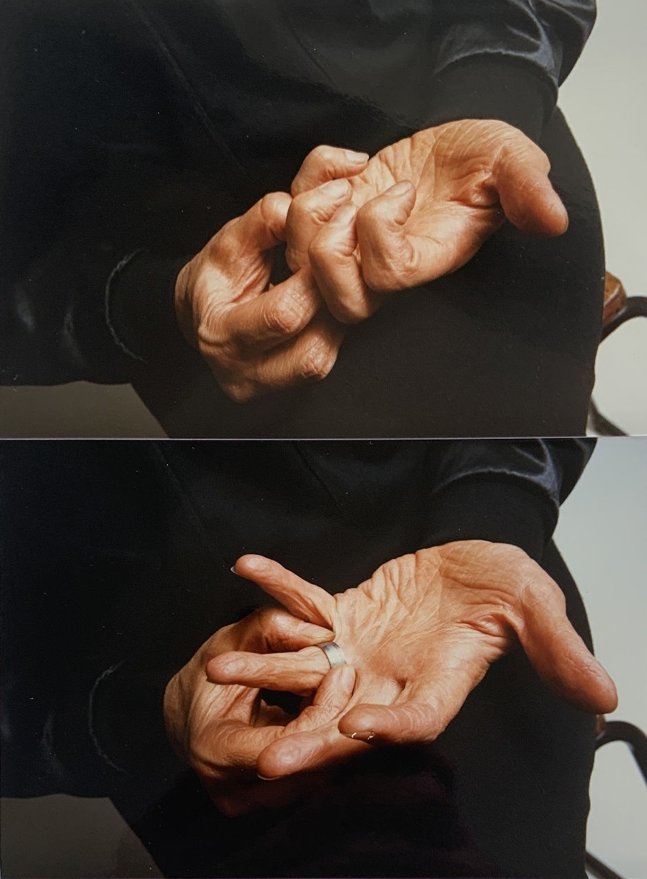 Jo Spence, Photo therapy: (Untitled - Wedding Ring), 1988-89