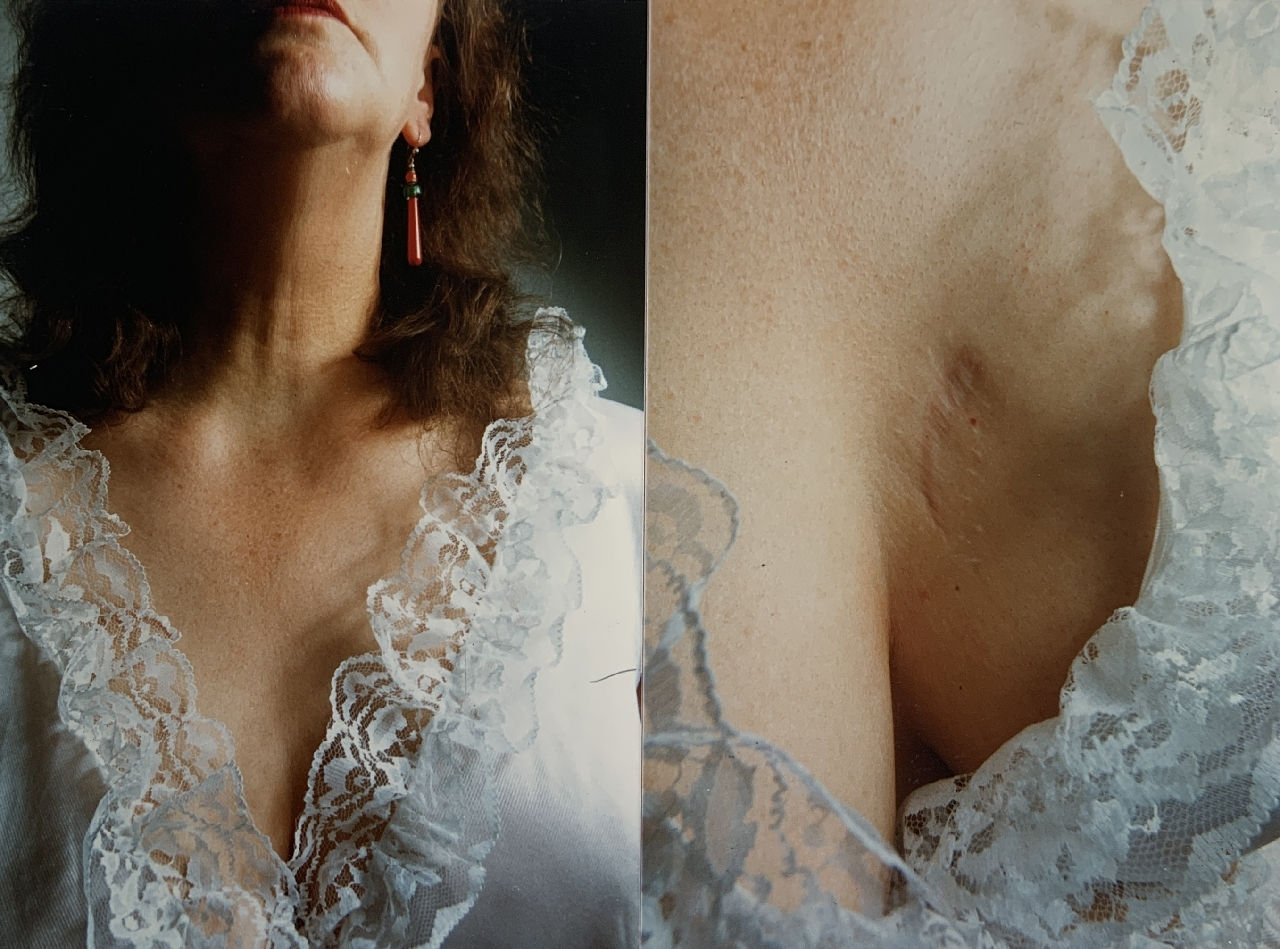 Jo Spence, Photo therapy: Shame Work (His Desire. Her Trauma), 1984