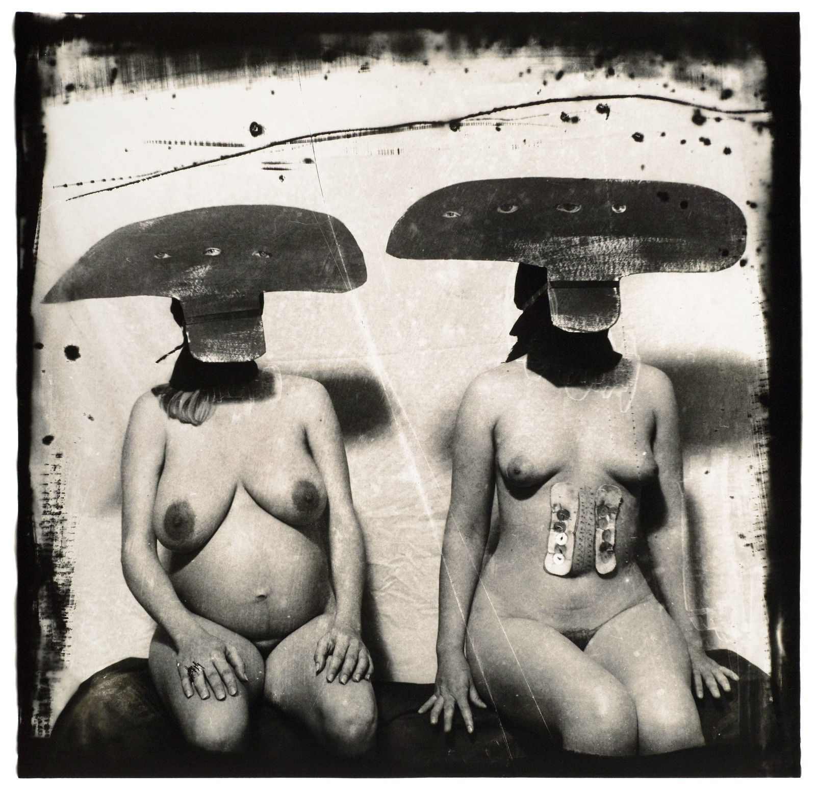 Joel-Peter Witkin, I.D. Photograph from Purgatory: Two Woman with Stomach Irritations, NM, 1982
