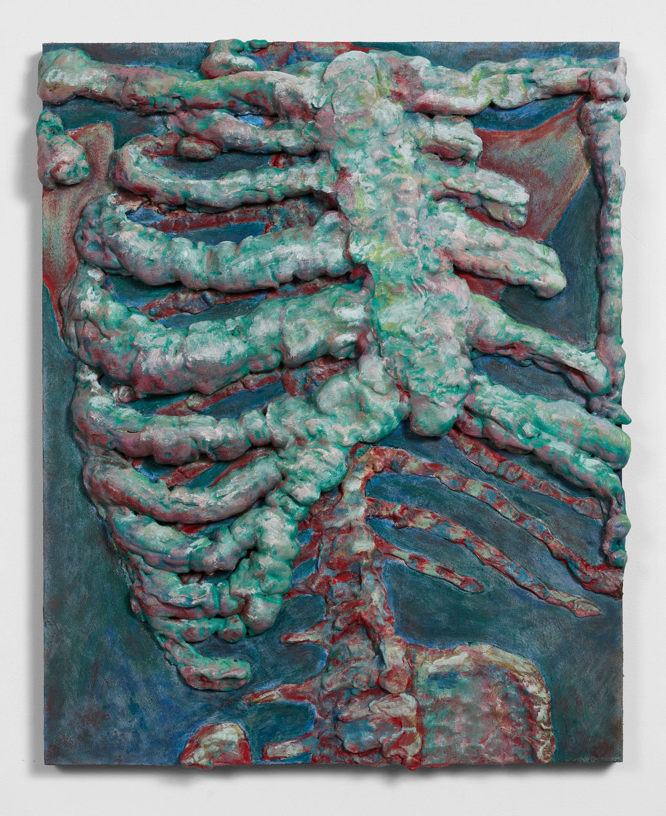A relief painting of a rib cage and spinal cord in blues and greens by artist Erik Dalzen.