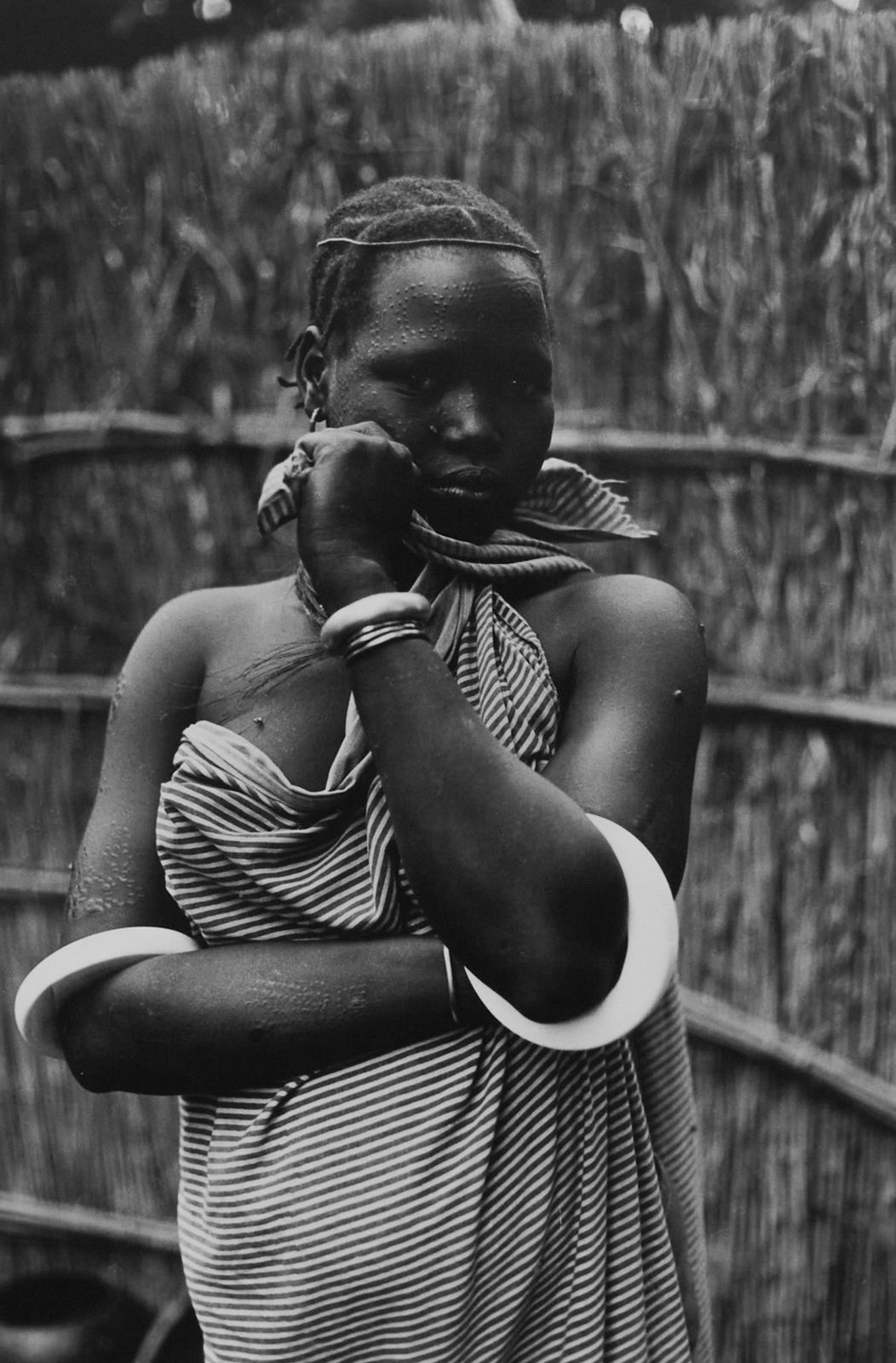 Ming Smith, Cicatrice Cosmetique, Gambela, Ethiopia, 1973