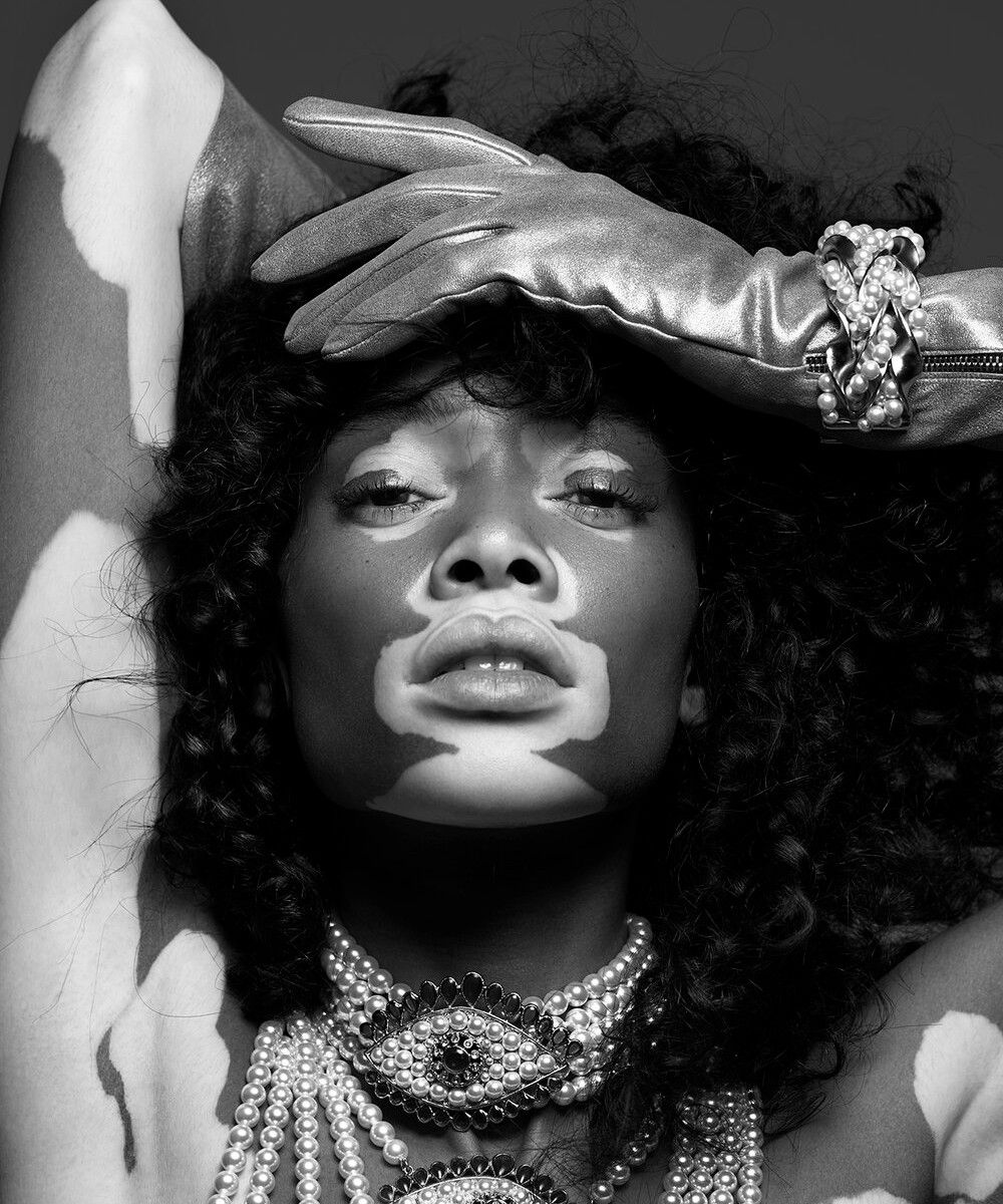 Rankin, Winnie Harlow, 2016