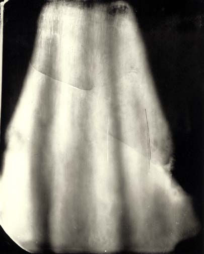 Sally Mann, Eva (#22 Velvet Skin), 2000