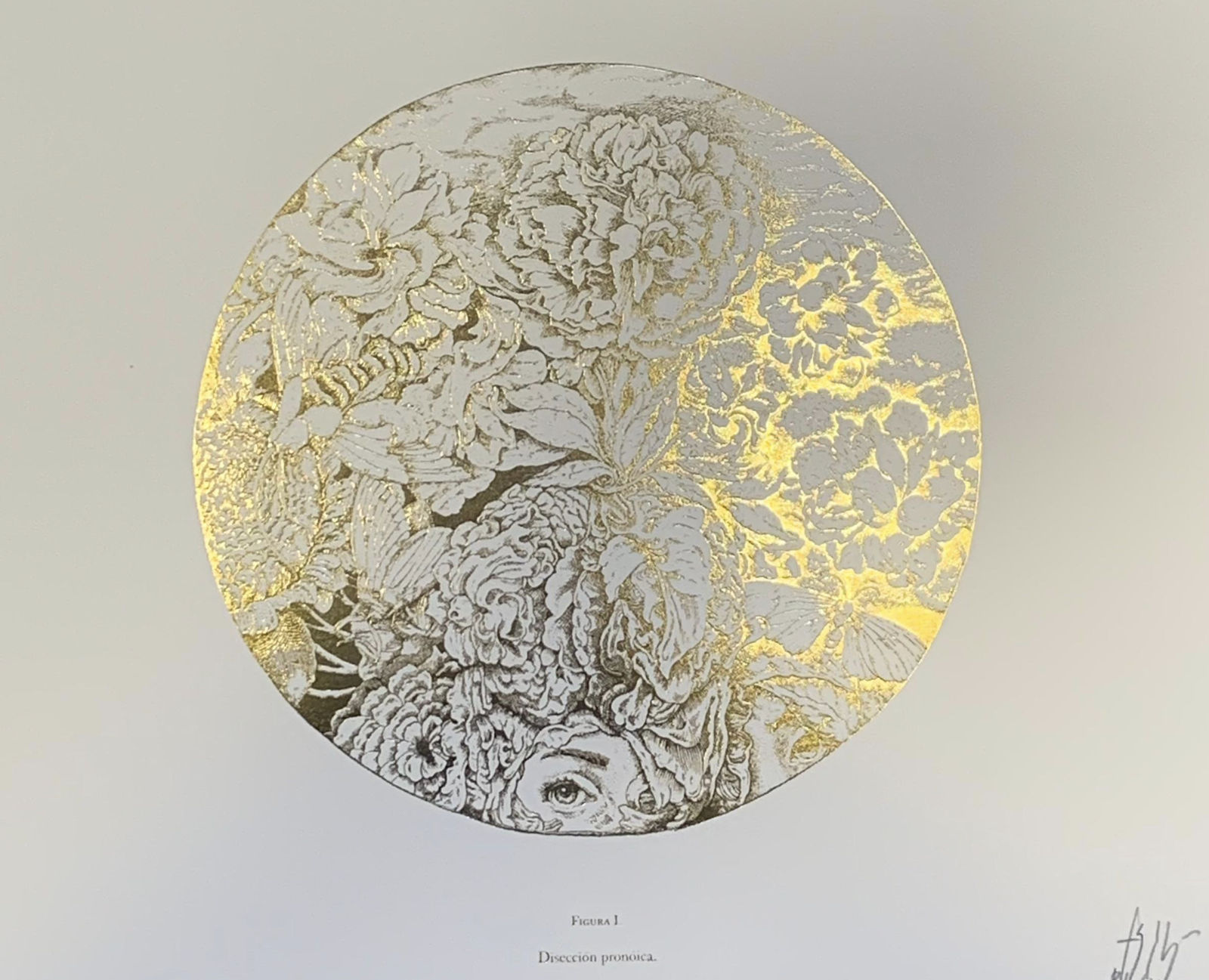 Edgar Bacalao, "Figura I. Disección pronóica", 2014