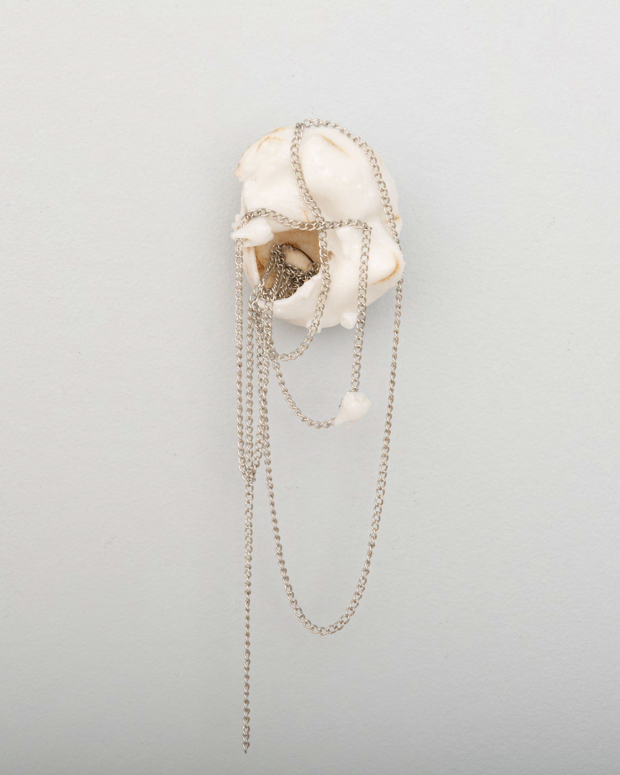 Liu Xin, teratoma, 2019