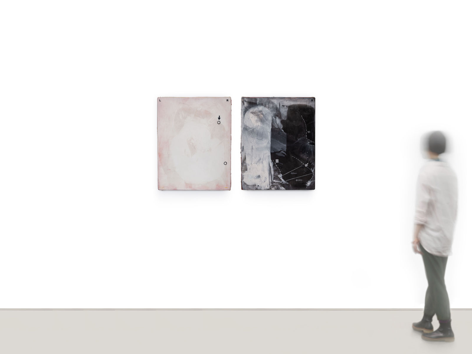 Sean Shim-Boyle, when you're about to start surgery #5 and you hear the dermatologists heading out of the hospital, 2025