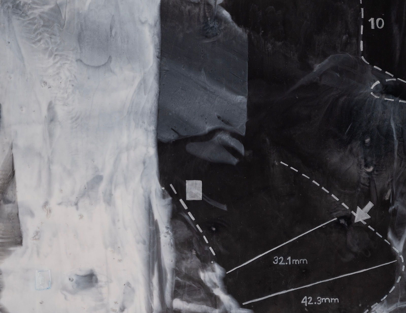 Sean Shim-Boyle, when you're about to start surgery #5 and you hear the dermatologists heading out of the hospital, 2025