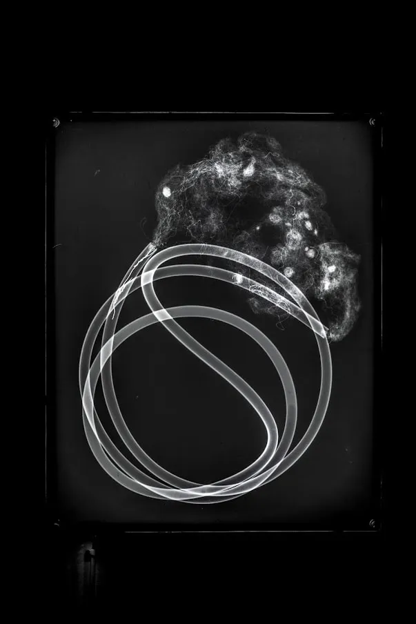 Prajakta Potnis, He Woke Up With Seeds In His Lungs 6, 2020