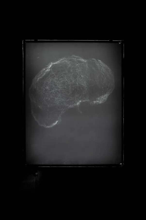 Prajakta Potnis, He Woke Up With Seeds In His Lungs 4, 2020