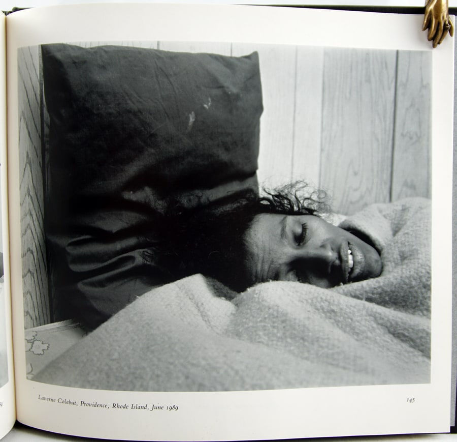 People with AIDS. Photograph