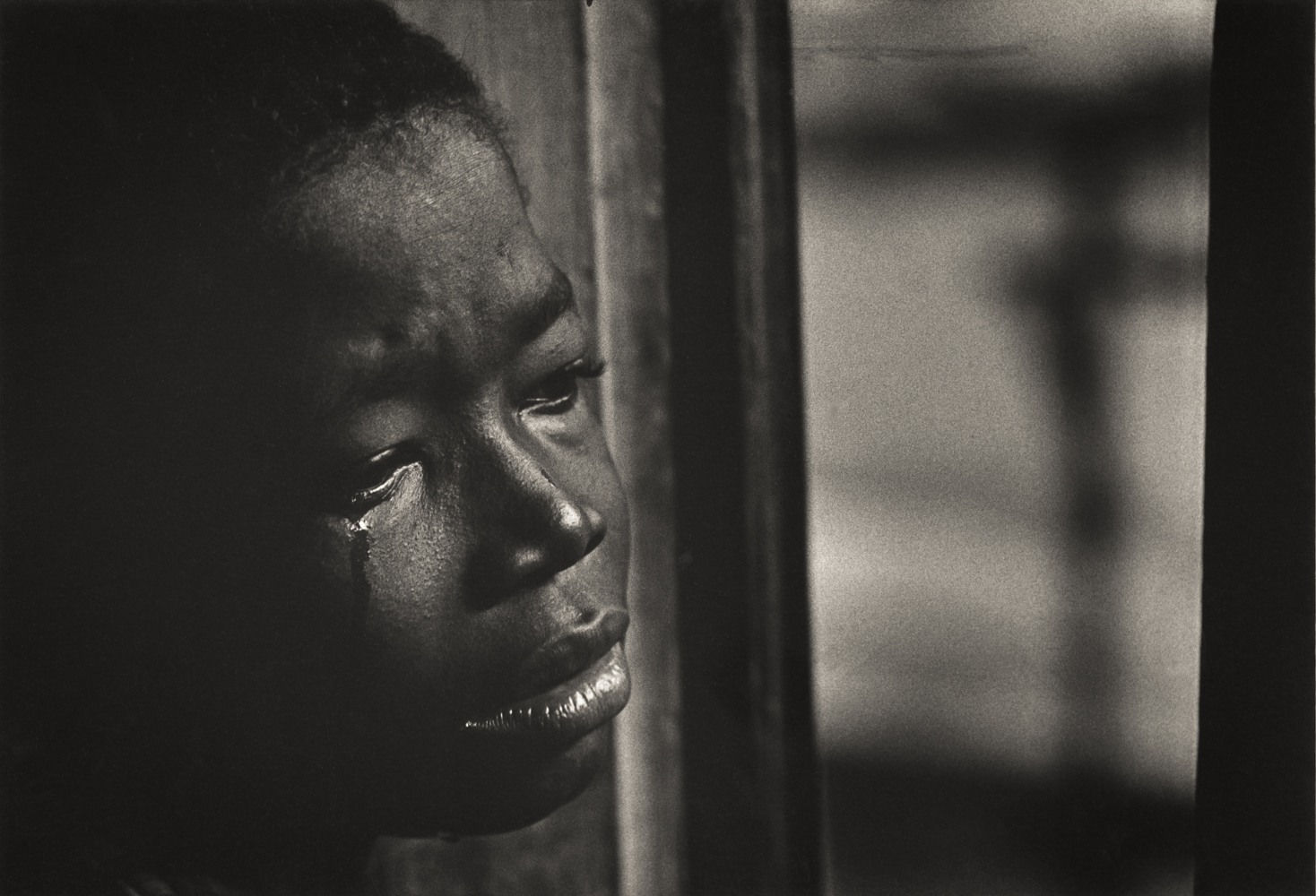 W. Eugene Smith, Sad Boy from the Albert Schweitzer story; "A Man of Mercy" for Life Magazine, 1954
