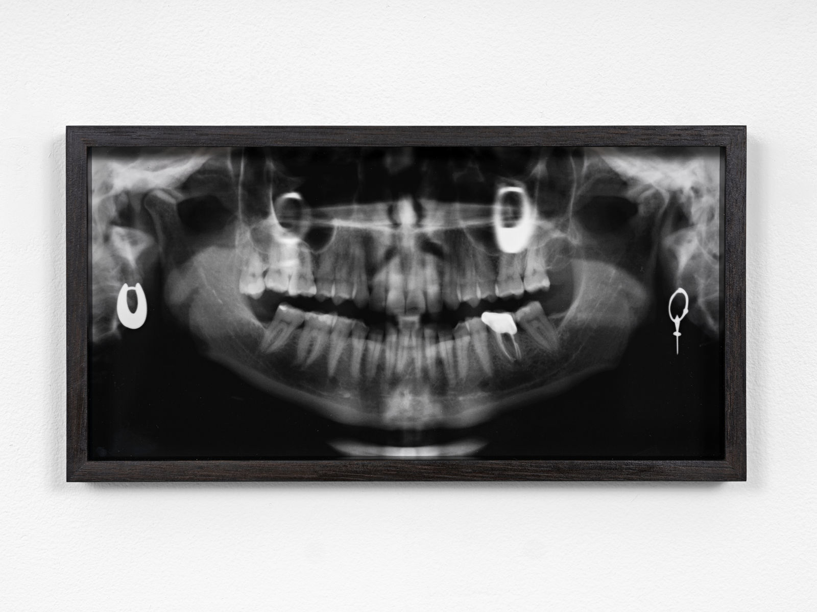 Ann Cathrin November Høibo, Hvis verden spør, så er svaret nei #5, 2020