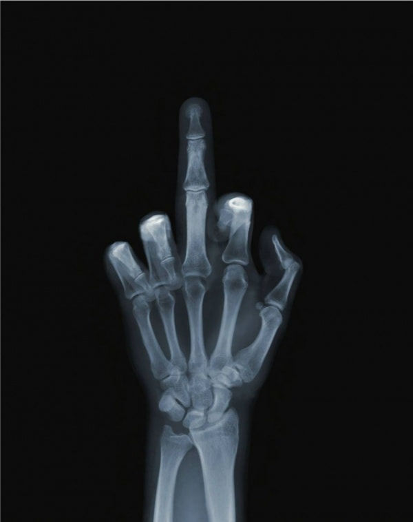 Nick Veasey, The Finger