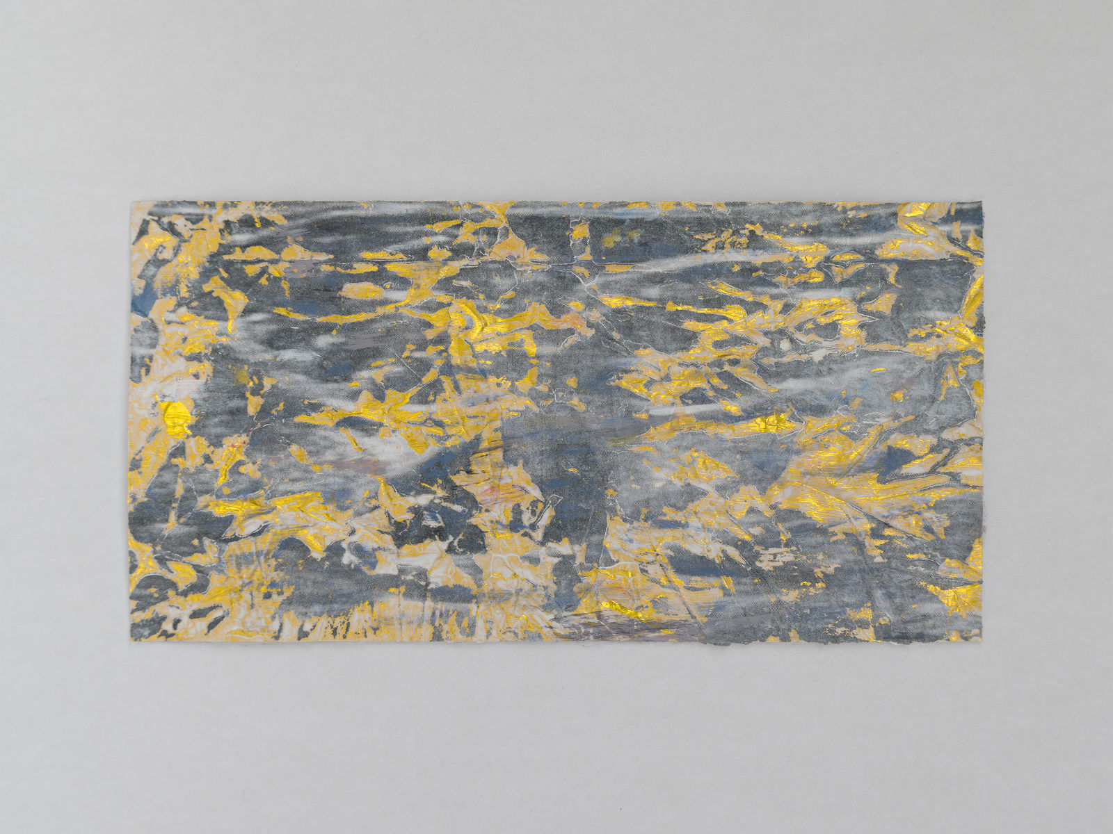 Jaspal Birdi, RT BREAST 6OCL 4CM FN 2, 2024