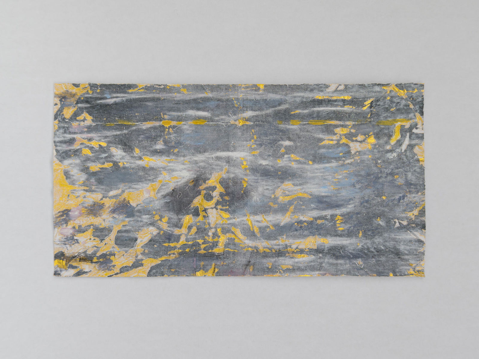 Jaspal Birdi, RT BREAST 6OCL 4CM FN 1, 2024