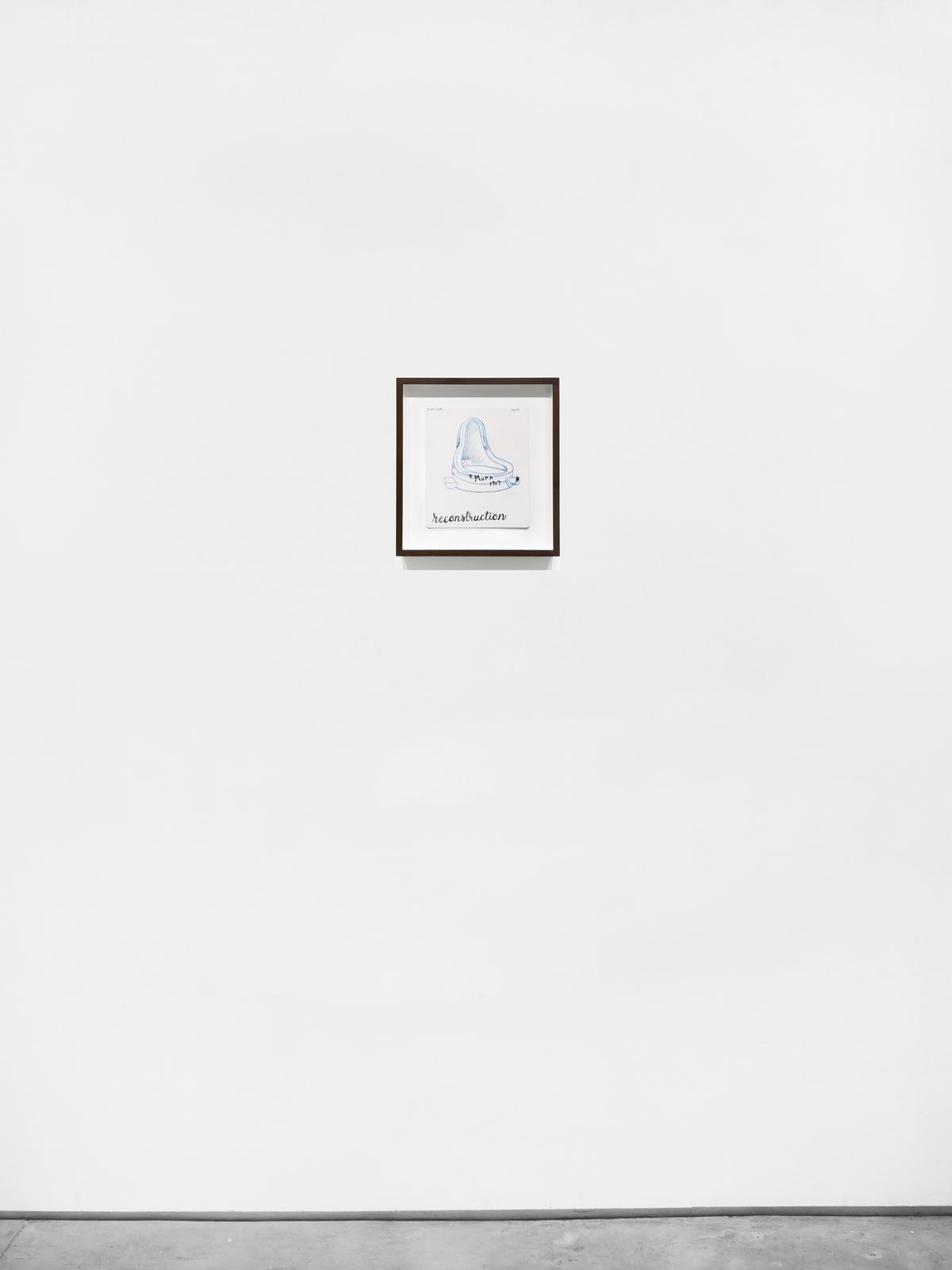 David McGee, reconstruction, 2018