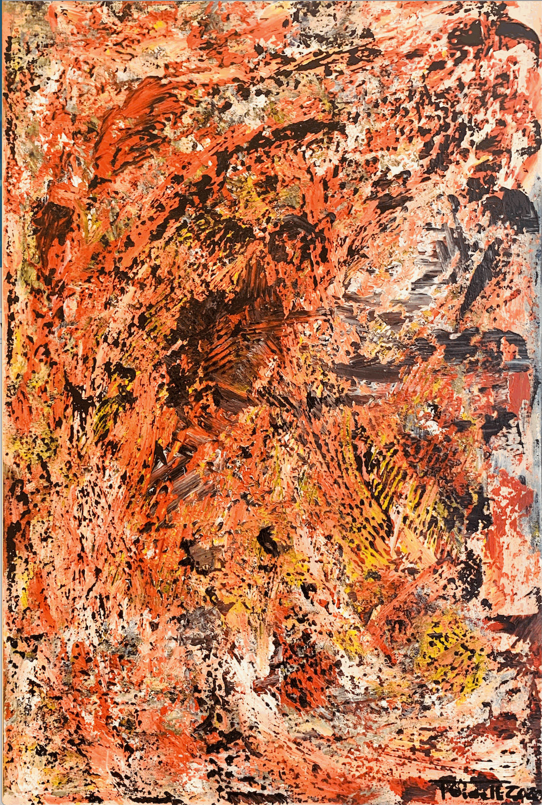 Tim Gianelli, Brain Trauma