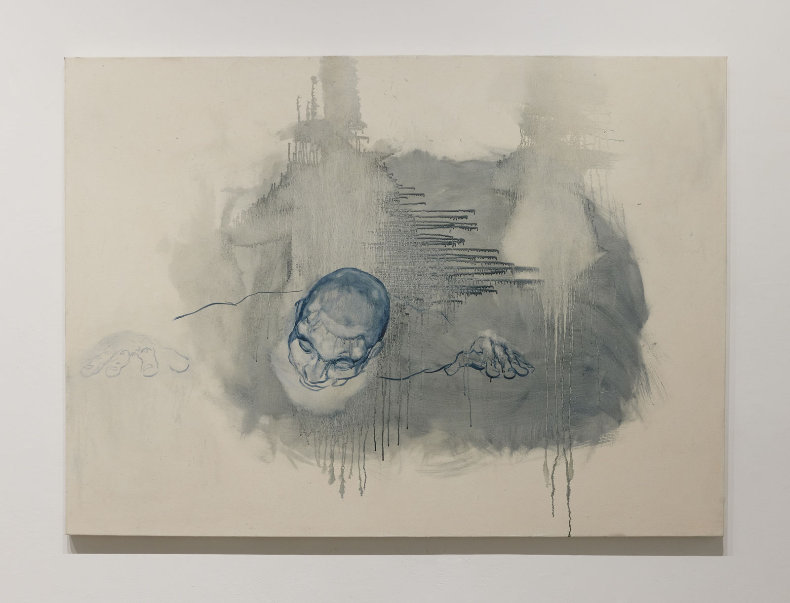 Dehiscence #1 by Kimberly R. Heard