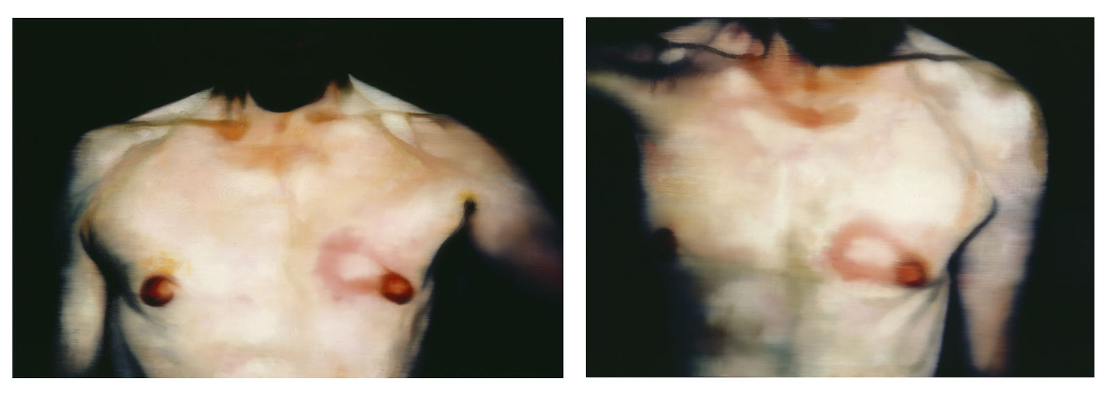 Johannes Kahrs, Therapy (stich), 2004