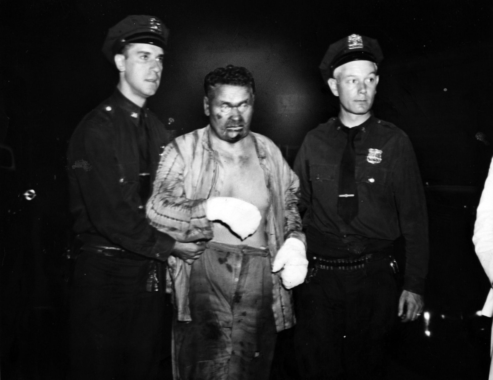 Weegee, Untitled (two policemen and man with bandaged hands), 1941