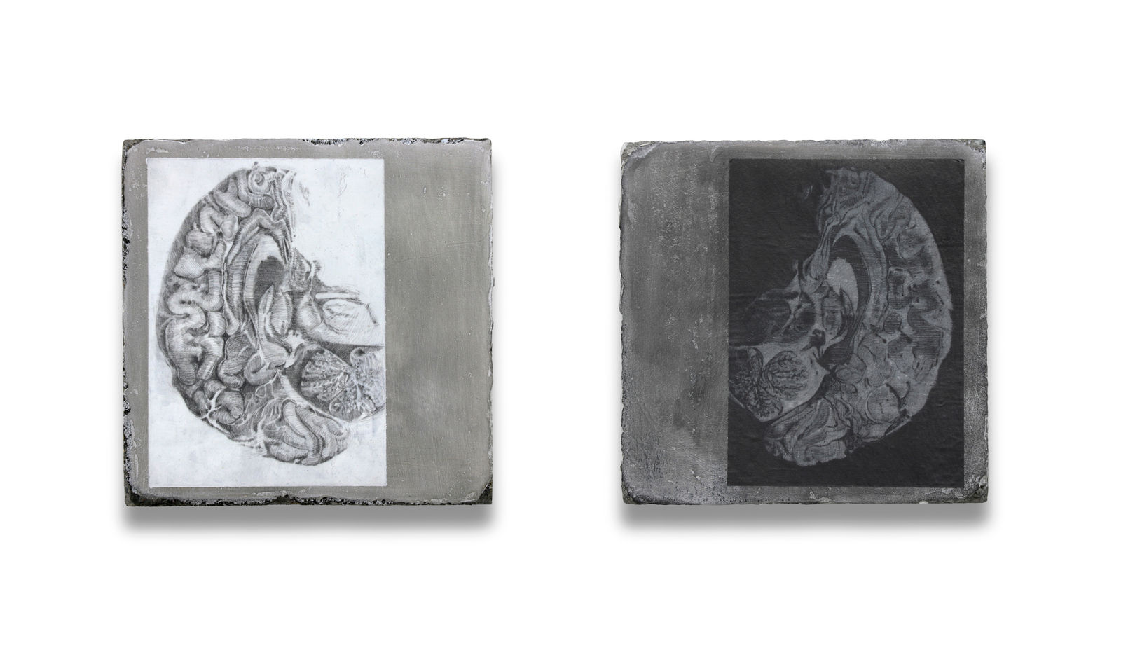 Synapse; Hippocampus 01-02 by Juanan Soria, 2025