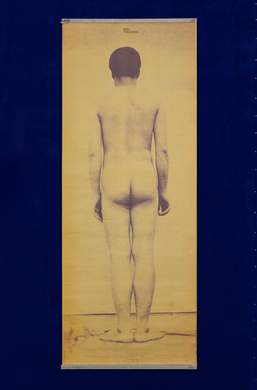 Tatsumi Hijikata - Archive, 中西夏之: 男子背面,Work by Natsuyuki Nakanishi, Back of Natsuyuki Nakanishi (From General Catalogue of Males '63), 1961