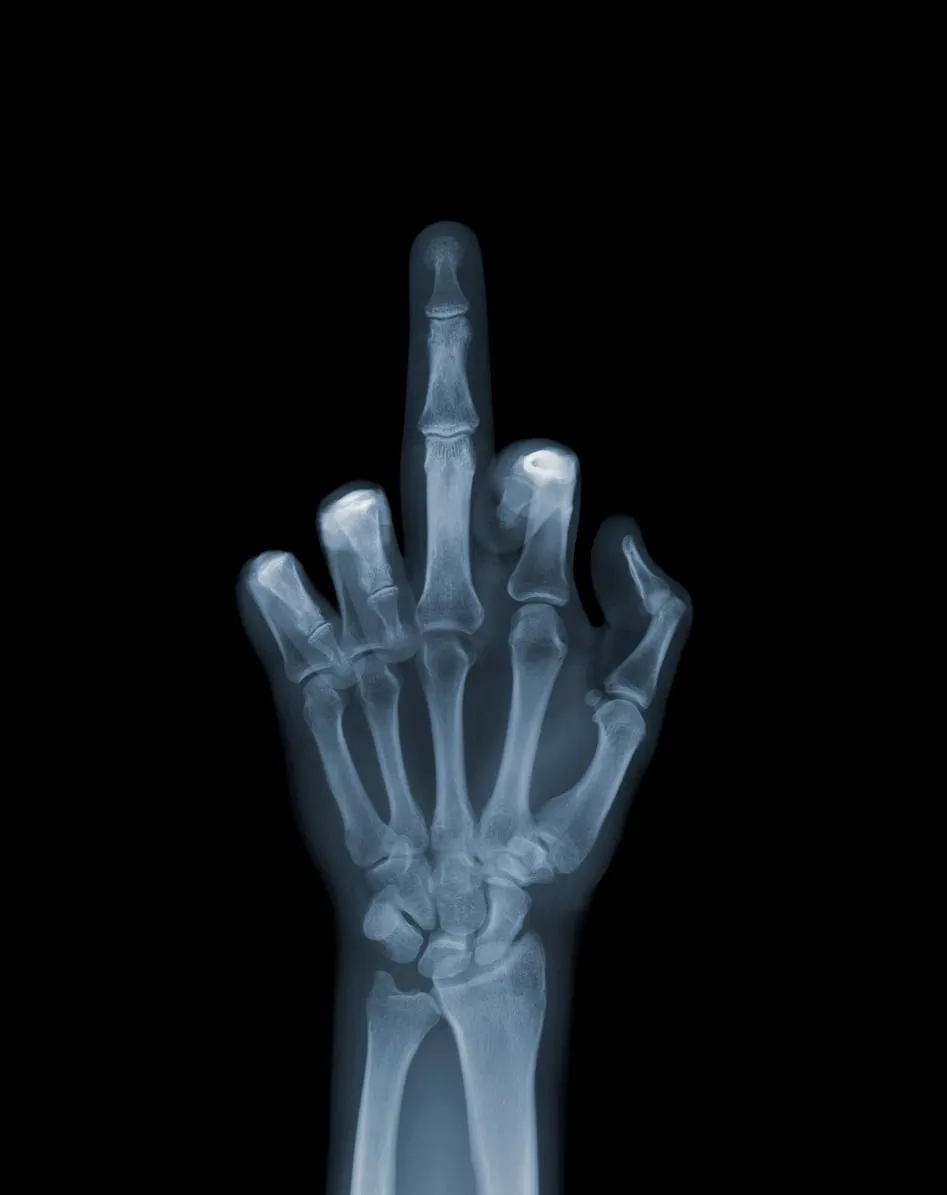 Nick Veasey, The Finger