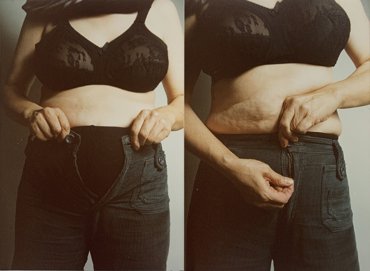 Jo Spence, Photo therapy: Breath In, c.1985