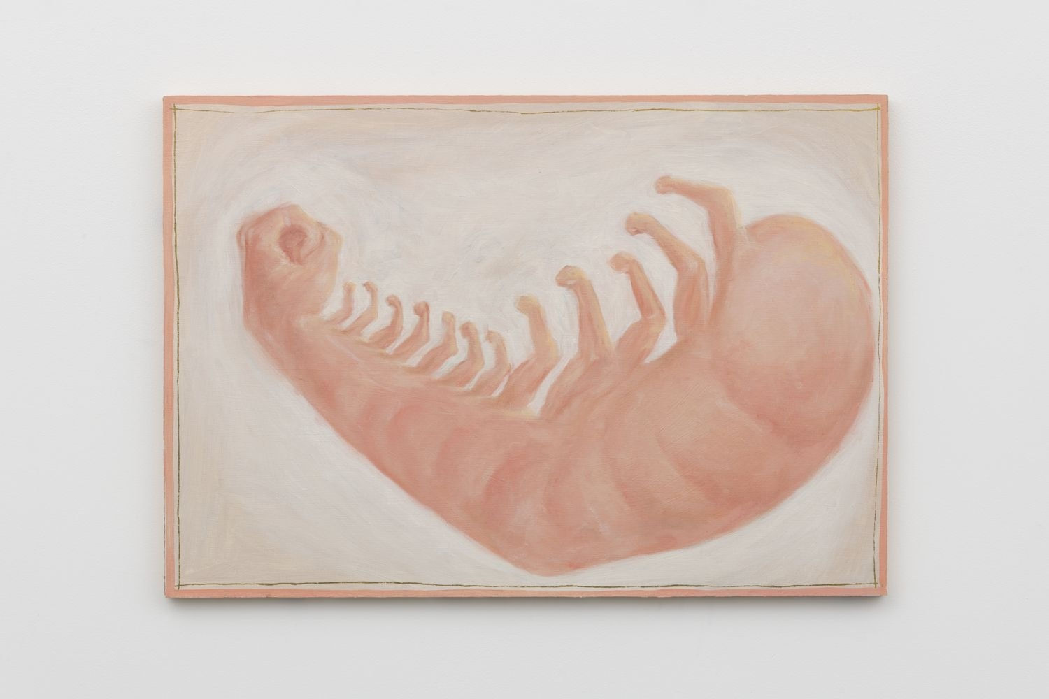 Tim Hawkinson, Martin (Muscle Flexing Shrimp Arm), 1995