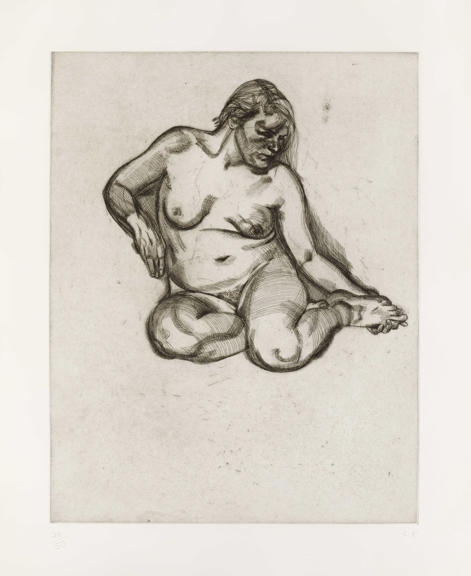 Girl holding her Foot, 1985