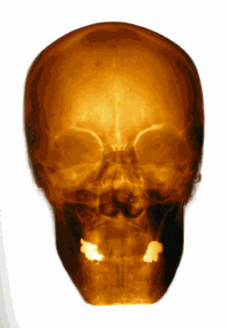 Alexander de Cadenet | Retrospective Book Launch x King Richard III Skull Portrait