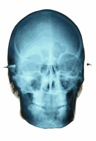 Alexander de Cadenet | Retrospective Book Launch x King Richard III Skull Portrait