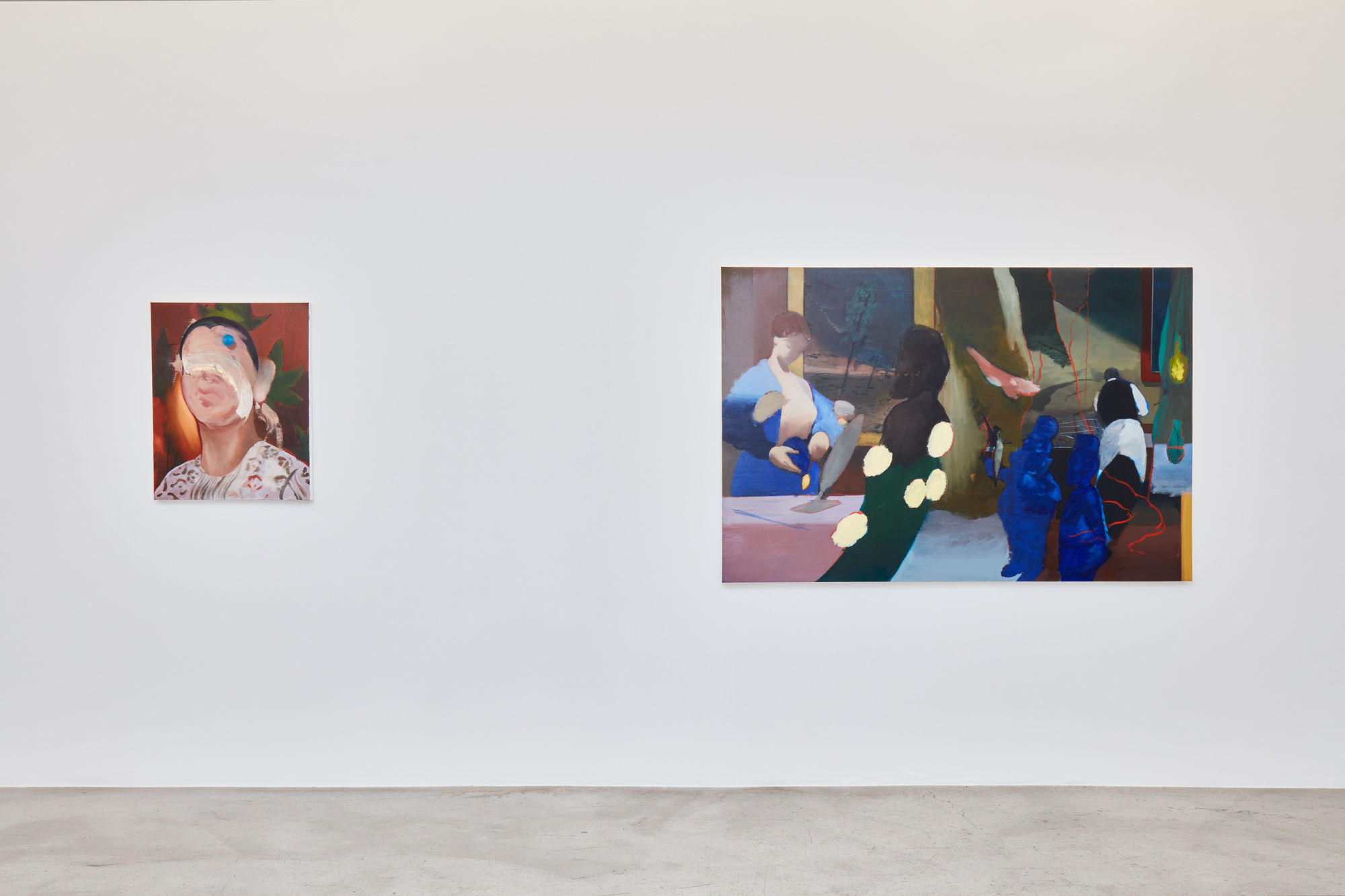 Installation view of Kenrick McFarlane: Naked & Famous at M+B, December 11, 2021 - January 22, 2022.