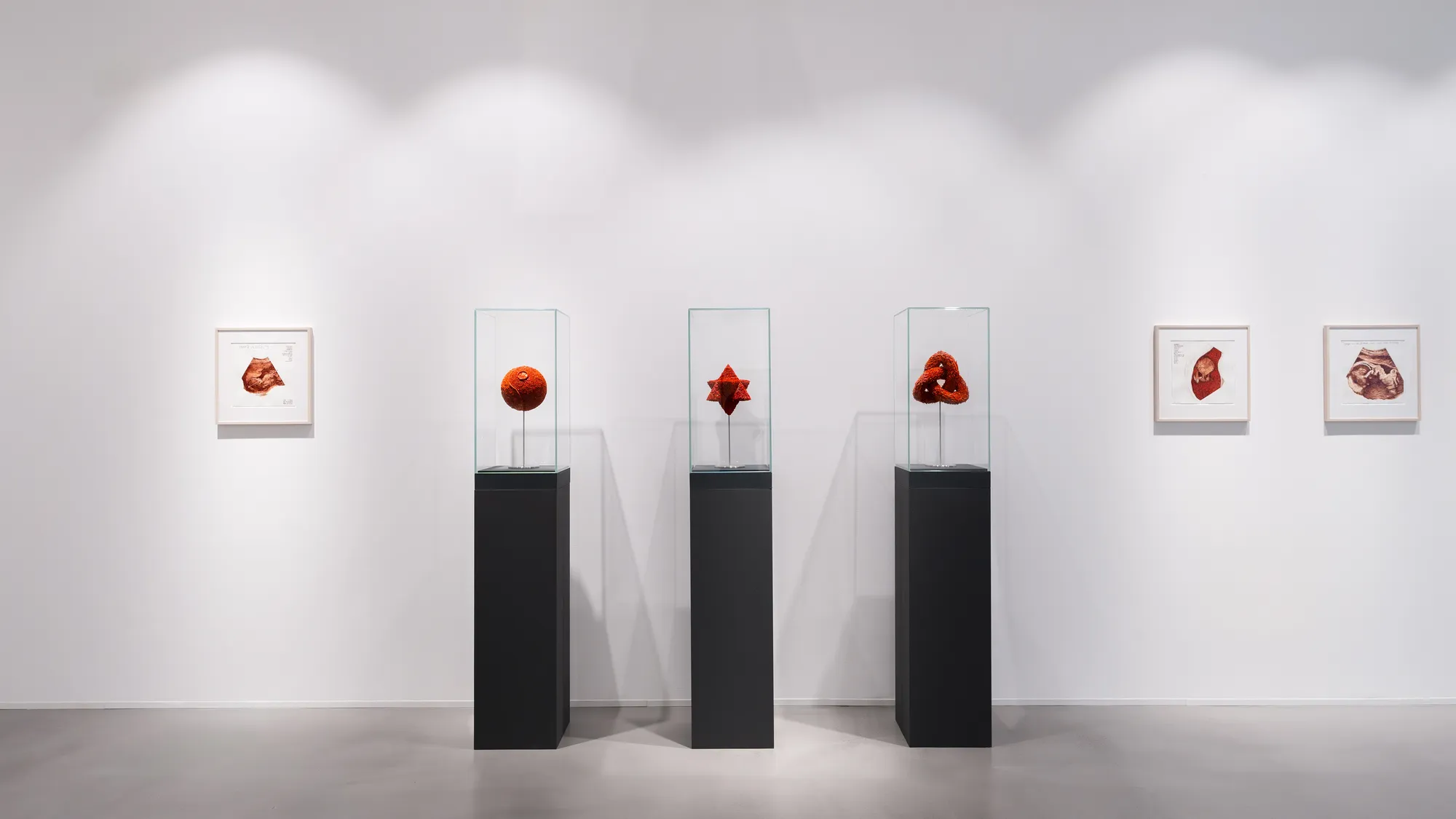 Allegory of Caritas (An Act of Love) - Installation View