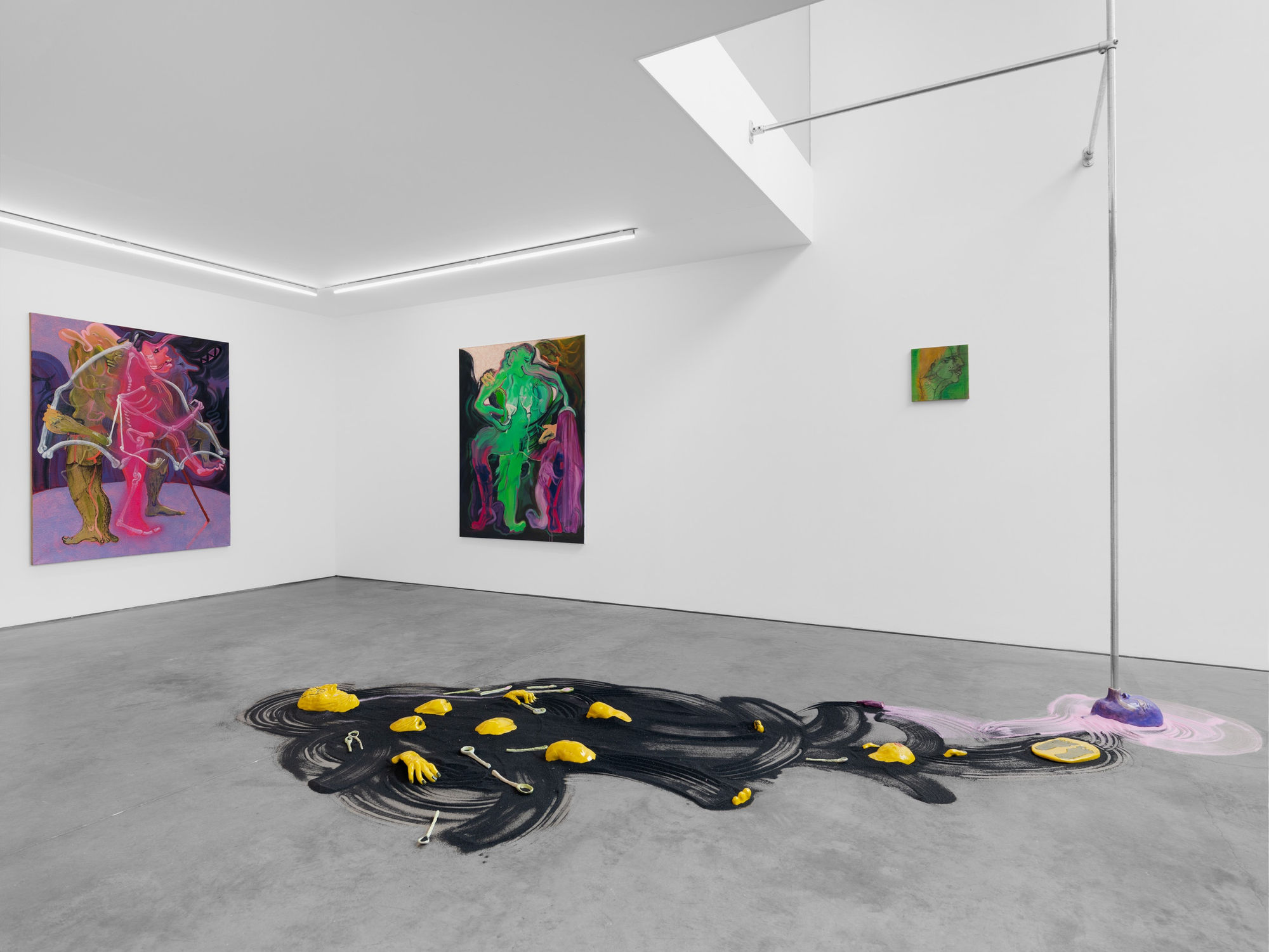 Sagger, Sinker, Wrinkler