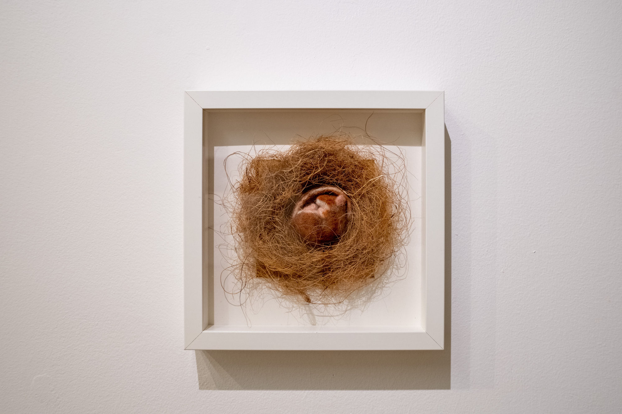 Sally Case 'Dreaming of a future'