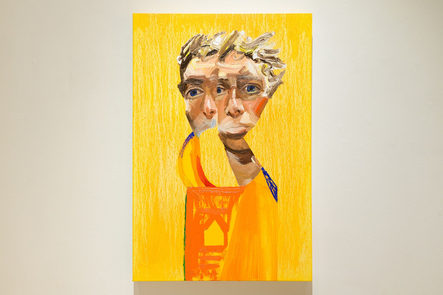 Erik Olson: Hēmikrāníā