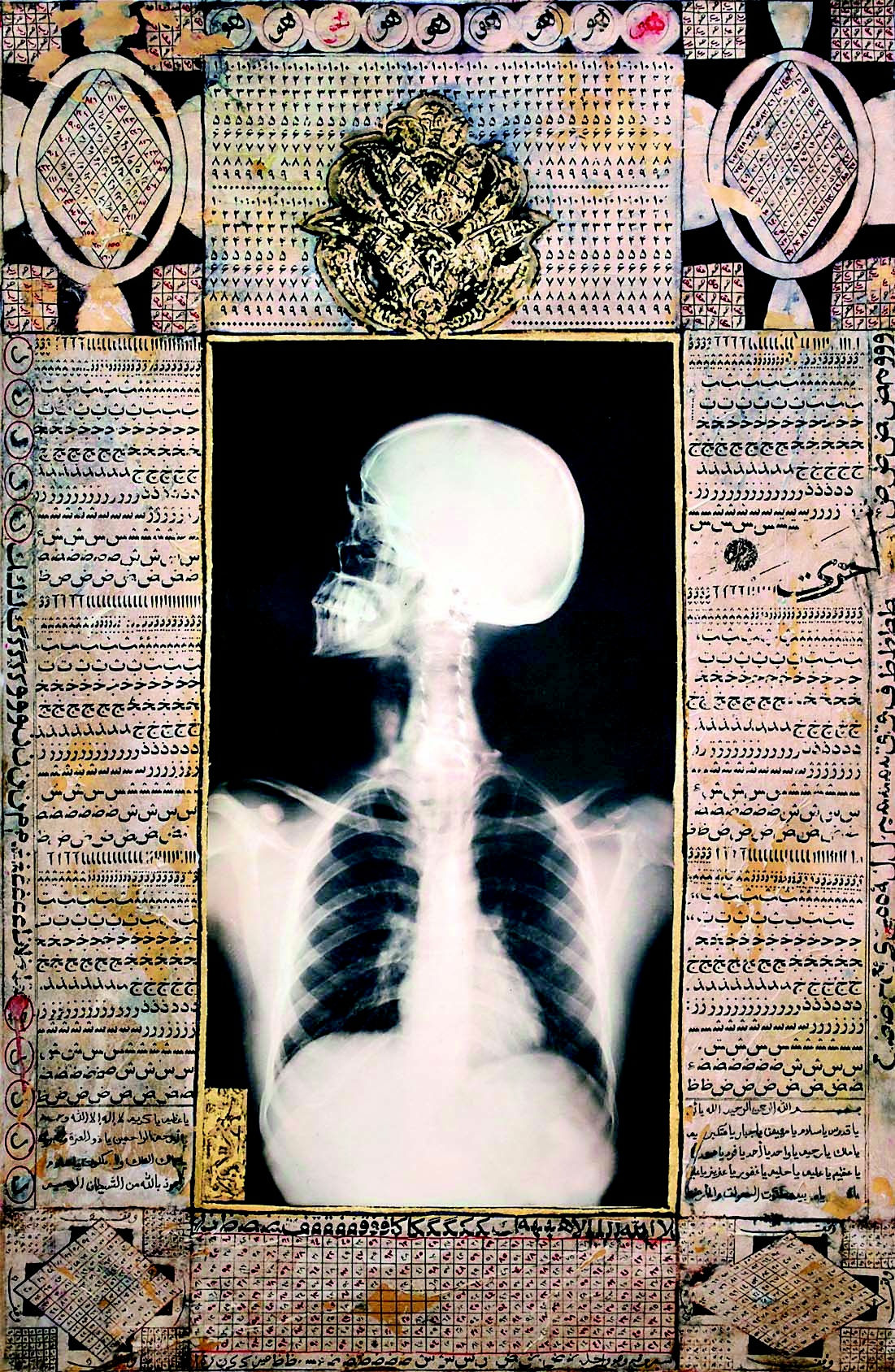 Ahmed Mater, X-ray 5