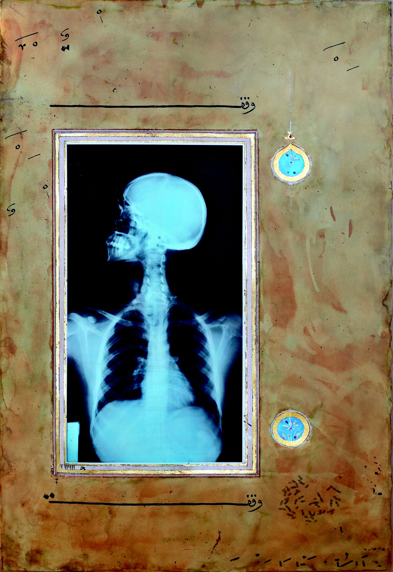 Ahmed Mater, Xray 4