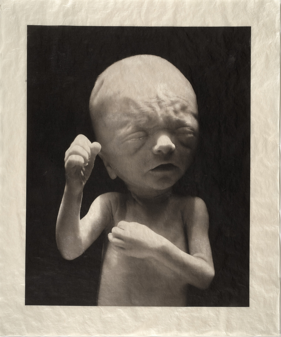 ELIZABETH HEYERT, THE UNBORN #6